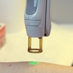 Laser ad alessandrite per l'attenuazione delle rughe