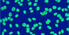 Risposta autoanticorpi IgG contro le caderine dei cheratinociti nel pemfigo foliaceo (Fogo Selvagem) endemico