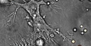 Fasi di apoptosi delle cellule di melanoma influenzano la maturazione delle cellule dendritiche mieloidi