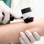 Dermatoscopia e classificazione di melanomi e lesioni benigne