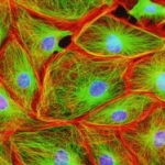 La mappatura con fluorescenza degli antigeni di superficie, attraverso l'uso della microscopia confocale a scansione laser, differenzia la dermatosi bollosa ad IgA lineari dall'epidermolisi bollosa acquisita e mediata da IgA