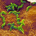 Helicobacter pylori e le malattie autoimmuni della pelle