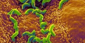 Ruolo dell'Helicobacter pylori nei comuni sottotipi di rosacea: Uno studio genotipico comparativo di pazienti egiziani