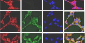 Efficacia fotodinamica fungicida dell'ipericina e del dimetil metilene blu contro i ceppi azolo-resistenti di Candida albicans
