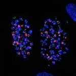 Strategie per invertire la disfunzione delle cellule T indotta dal melanoma