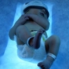 Rischi a lungo termine della fototerapia neonatale con luce blu