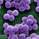 La colonizzazione cutanea da parte dello Staphylococcus aureus è promossa dalla distruzione della barriera e porta ad infiammazione locale