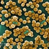 Staphylococcus aureus sovverte la barriera cutanea attraverso la D-alanilazione degli acidi teicoici