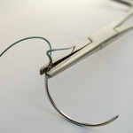 Il materiale da sutura con antibatterici diminuisce i tassi di infezione