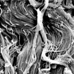 Gli stimoli di trazione aumentano il fattore di crescita nervoso nei fibroblasti dermici umani indipendentemente dalla produzione di TGFβ indotto dalla tensione