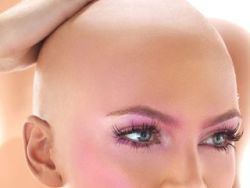alopeciachemioindotta
