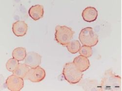 CD163-cells