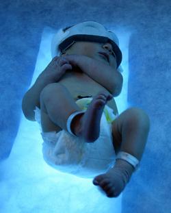 neonatal-blue-light