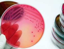 rapidly-growing-mycobacteria