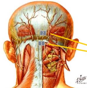 intractable-trigeminal-neuralgia