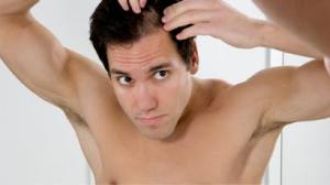 male-androgenetic-alopecia