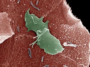 Trichomonas-vaginalis