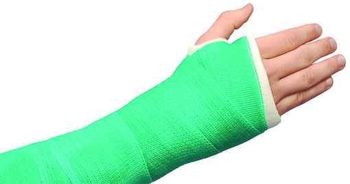arm cast fracture