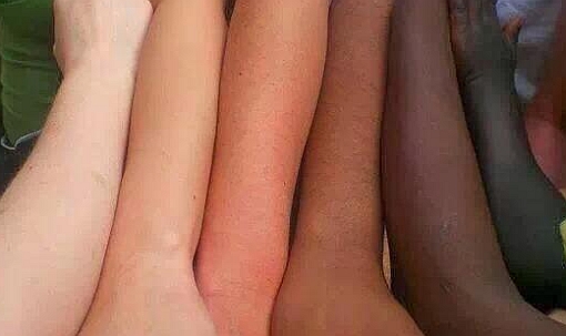 different skin types